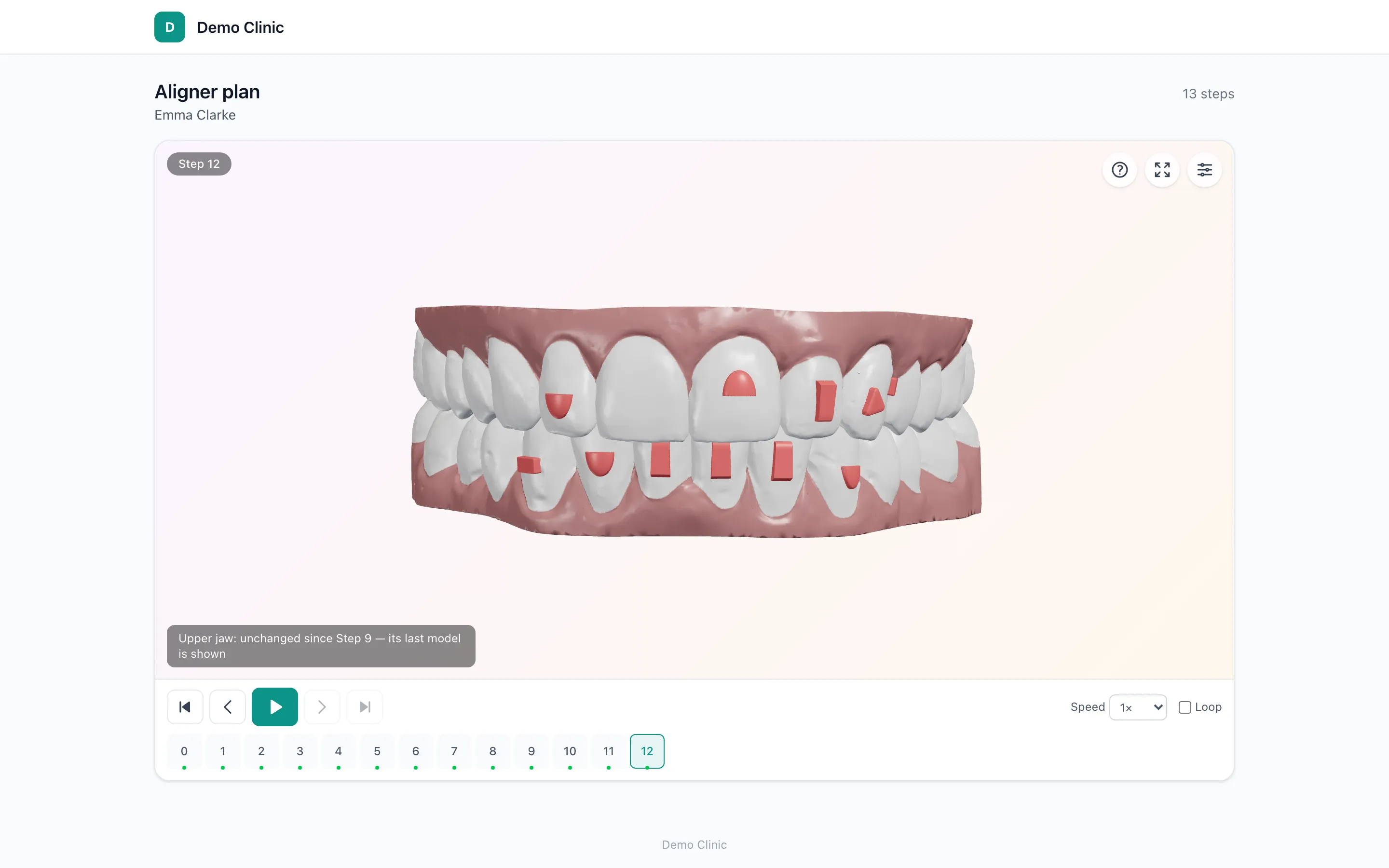 The Dentify3D viewer showing the final step of an aligner treatment with attachments
